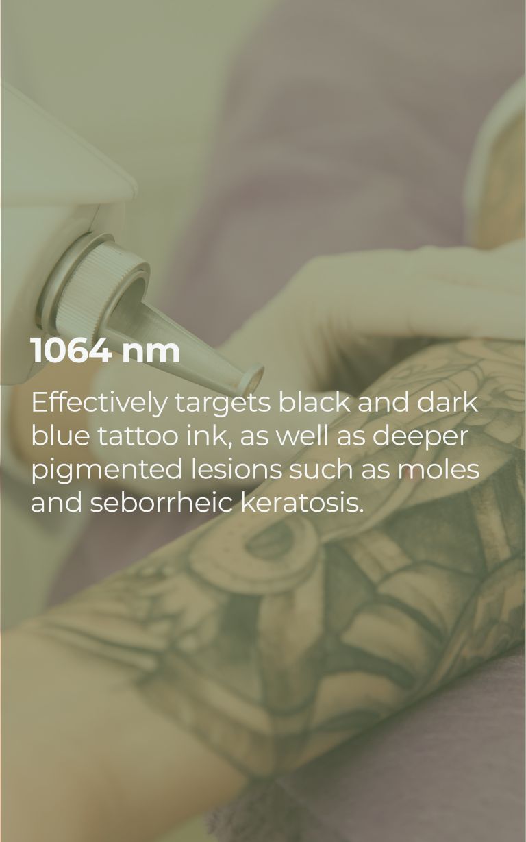 pico-laser-slide-01-03