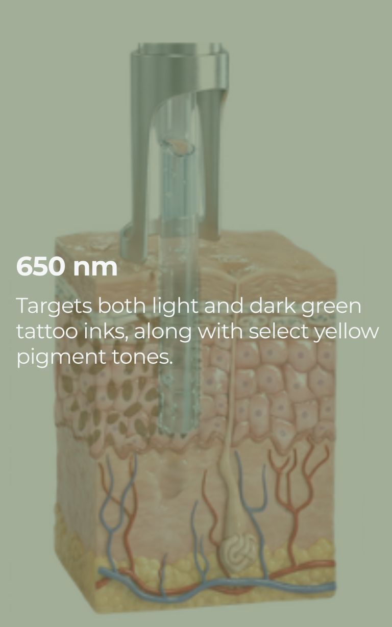 pico-laser-slide-01-05