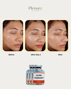 Bring Back Your Clear & Healthy Skin! 💖Say goodbye to acne, dark spots, and inflammation with